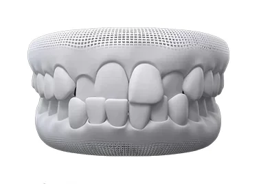 Invisalign