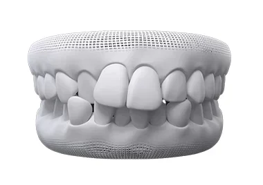Invisalign