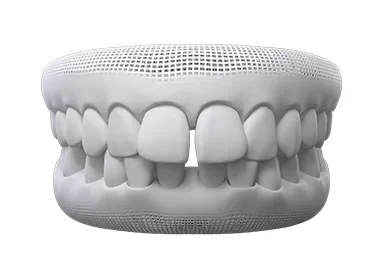 Invisalign