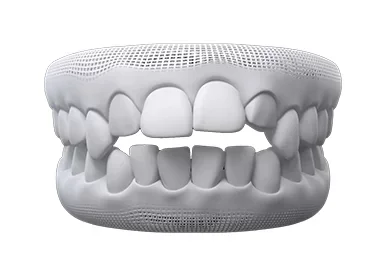 Invisalign